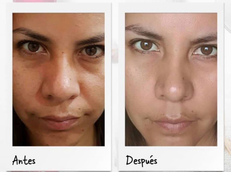 Cremas para rostro rejuvenecer
