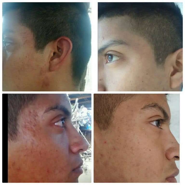 Tratamiento facial para hombres con cremas. Imagen Personal Masculina